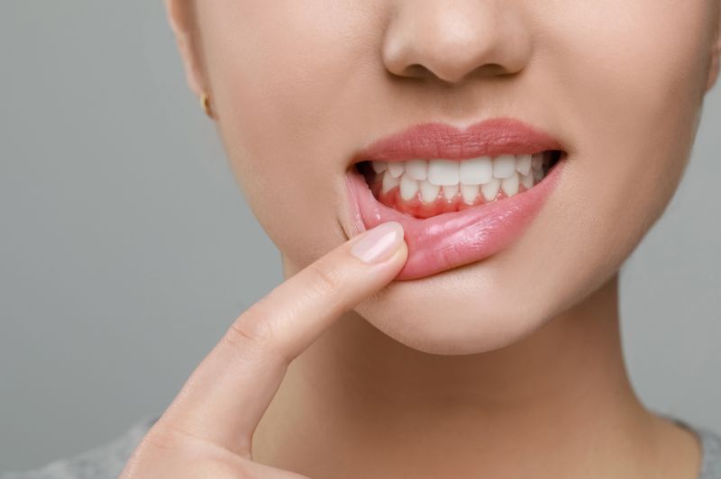 舌癌か口内炎を患っている女性