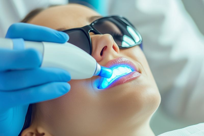 オフィスホワイトニングの施術の様子