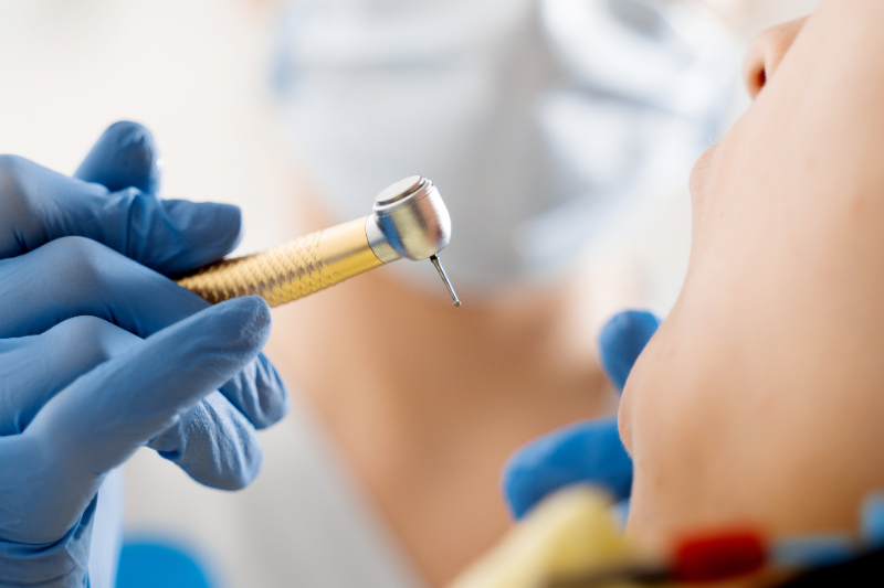 歯を削る歯科医師の手元
