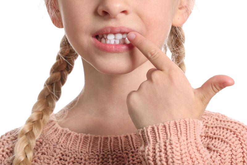 顎が小さい子どもの歯並びの様子