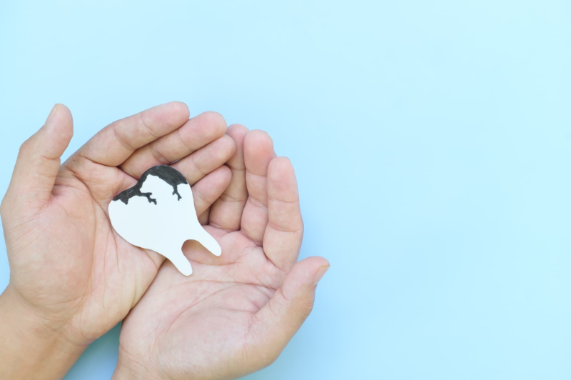 虫歯治療のイメージ