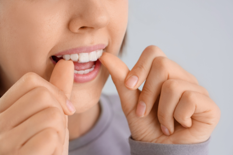 インビザライン矯正のマウスピースを装着する女性