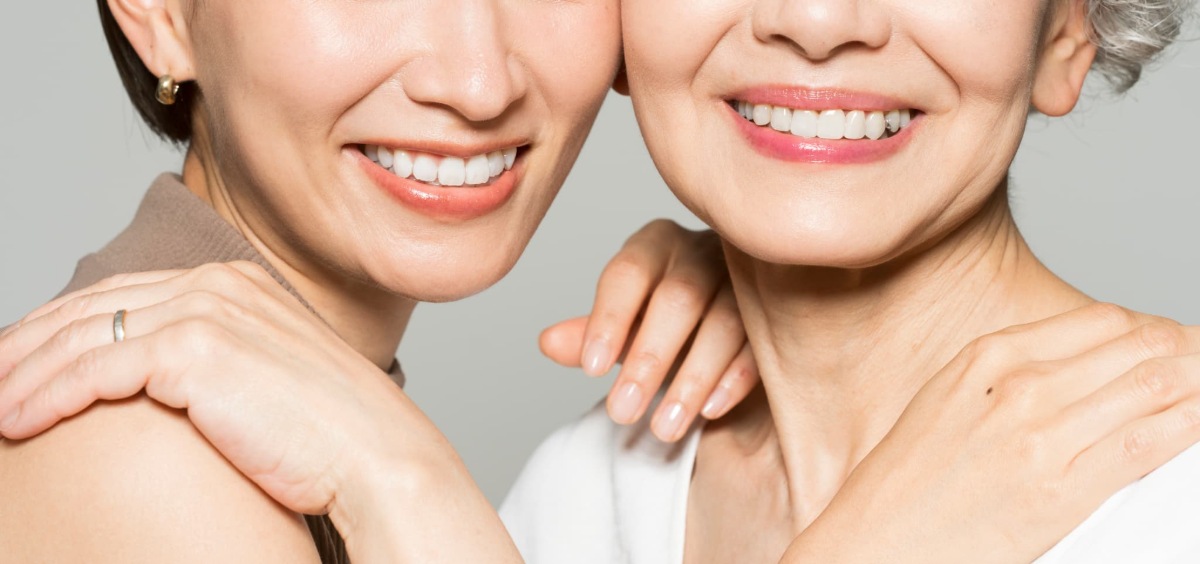 ホワイトニングをした白い歯で笑顔で抱き合うミドルとシニア女性