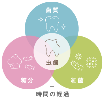 虫歯の原因は「歯質」「糖分」「細菌」と時間の経過