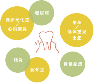 動脈硬化症／心内膜炎、糖尿病、早産／低体重児出産、骨粗鬆症、認知症、肺炎